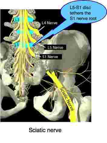 Lower back and leg pain is the most common complaint heard in the chiro