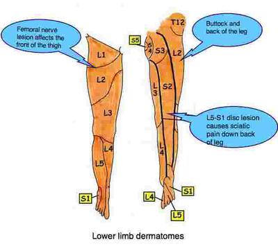 lower back pain and muscle spasm after lifting