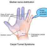 Femoral nerve/spinal injury vs piriformis sciatica pain