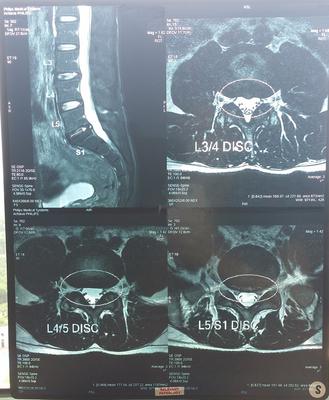 Left Front Thigh Pain diagram foot pain locations 